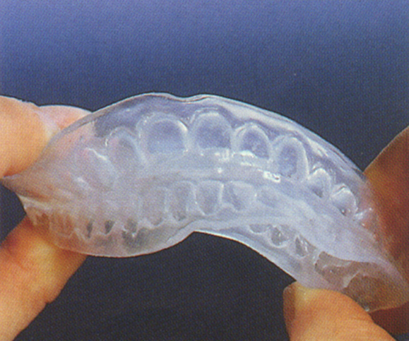 Elastoligner 2 300dpi.JPG (148664 Byte)