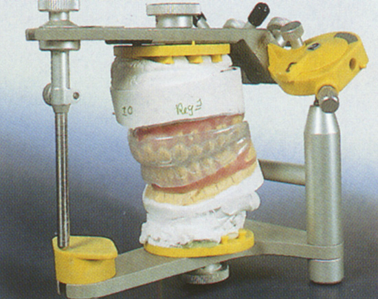 Elastoligner 3 300dpi.JPG (134766 Byte)